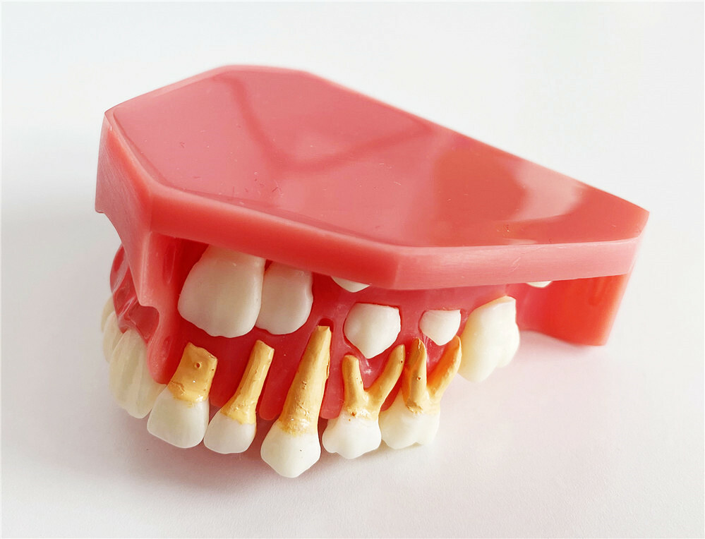 Dental Teaching Pediatrics Teeth Children 5-9Years Old Permanent Alternate Model