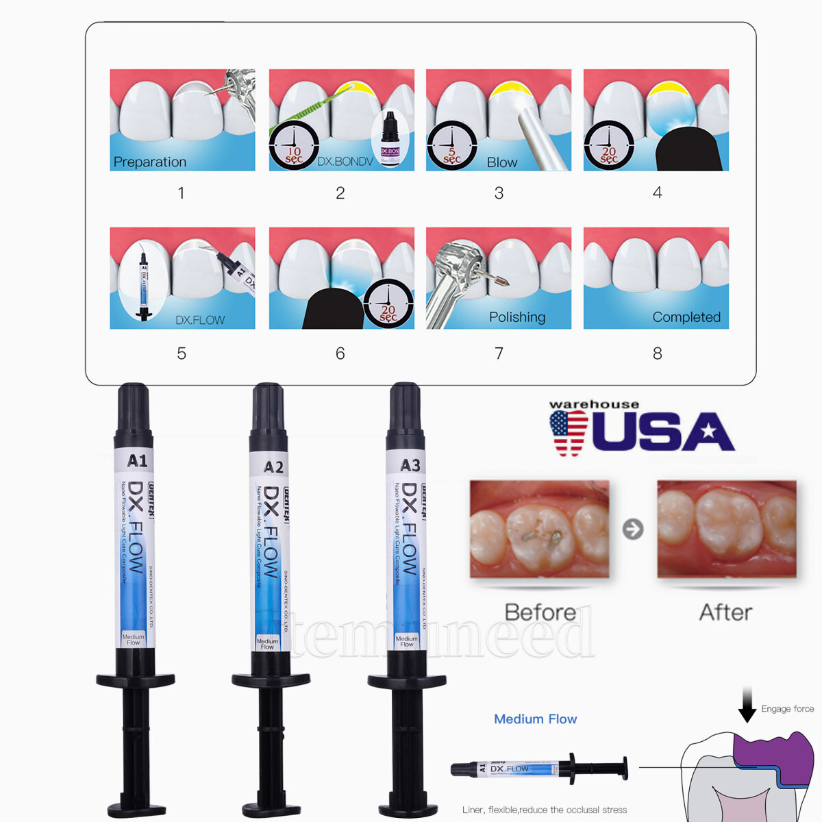 DX.FLOW DENTEX Flowable Medium Flow Light Cure Composite Resin A1, A2, A3