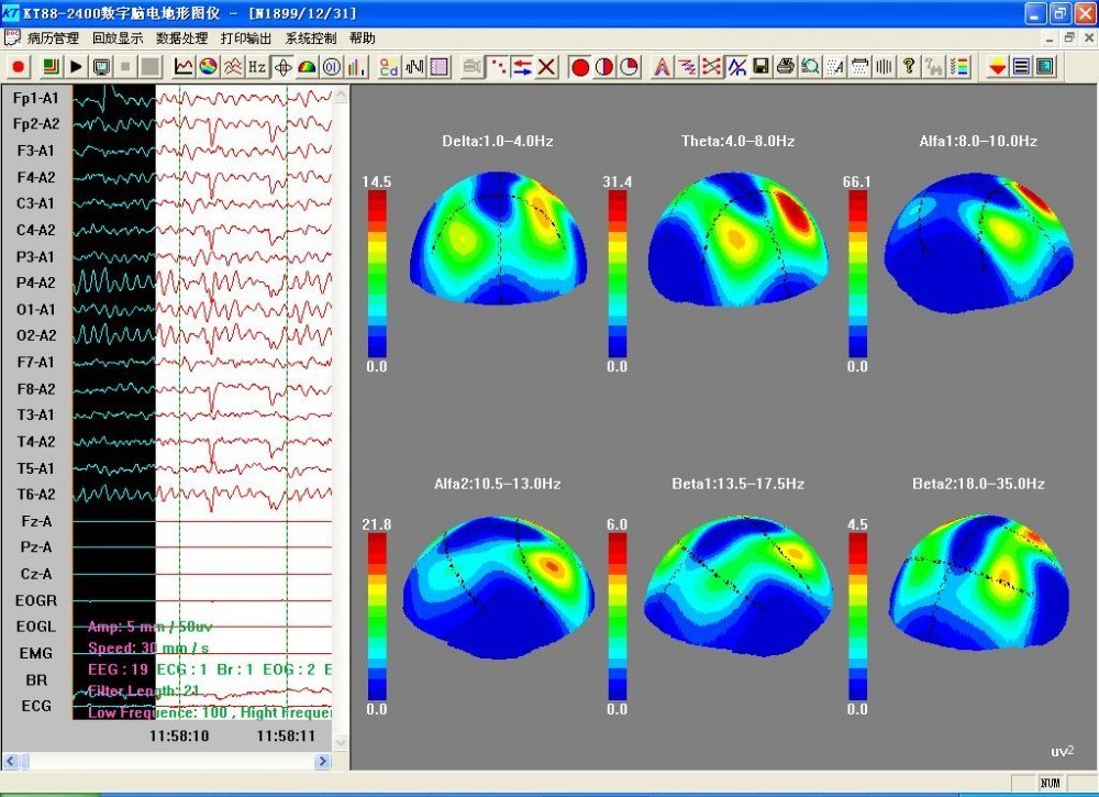24-Channel EEG Mapping Software Compatible w/ KT88-2400 – Ships USA
