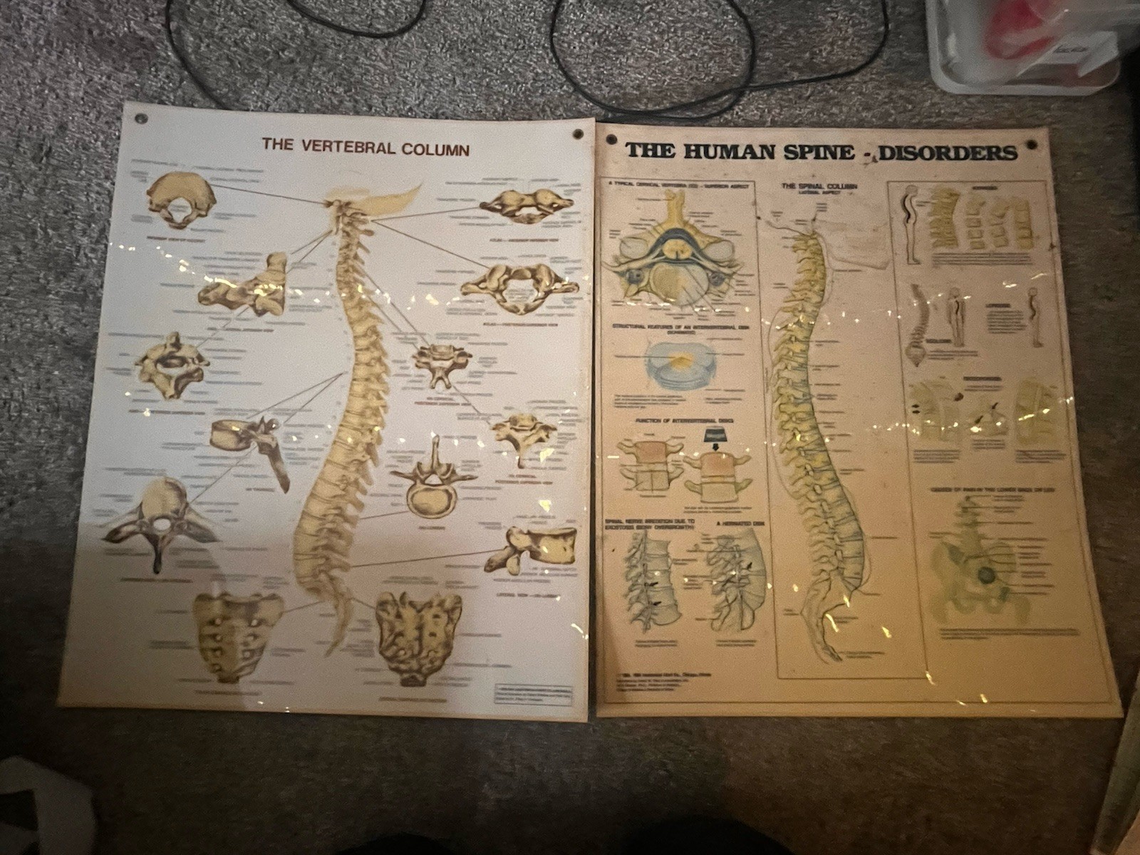 1980 Vertebral Column Spine Anatomical Chart & Spine Disorders Laminated Poster