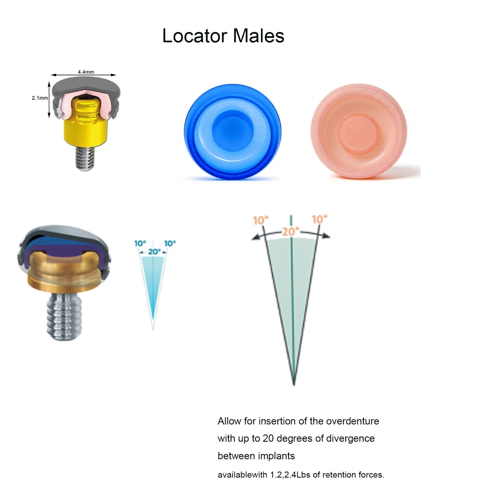 US Hiossen ET Locator Anchor Mini/Regular Implant Retained Removable Overdenture