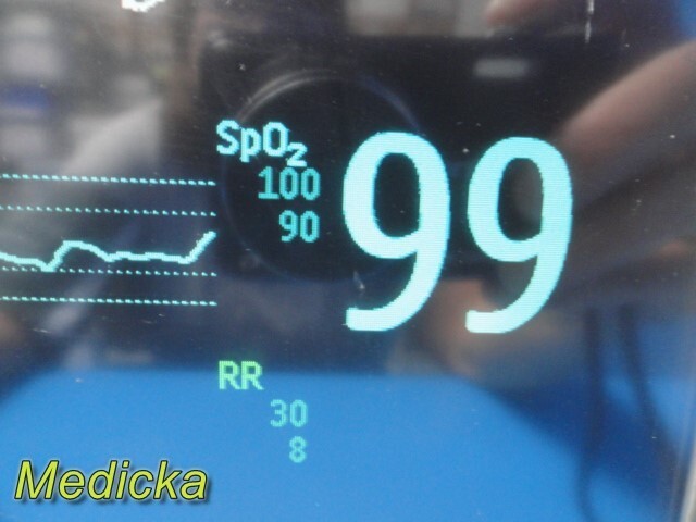 2010 Philips Intellivue MP30 Patient Monitor W/ MMS Module & NEW Leads ~ 35383