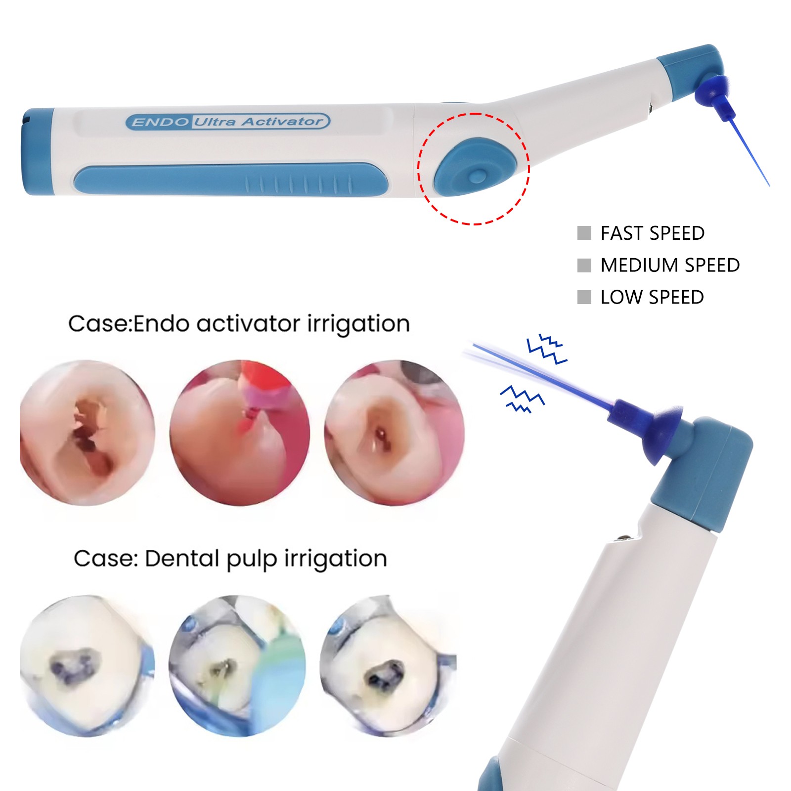 Dental LED Endo Ultrasonic Sonic Activator Root Canal Irrigator + 150Tips Free
