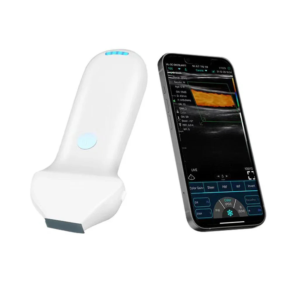 192E Wireless Color Doppler Ultrasound Probe Facial High Frequency Linear Probe