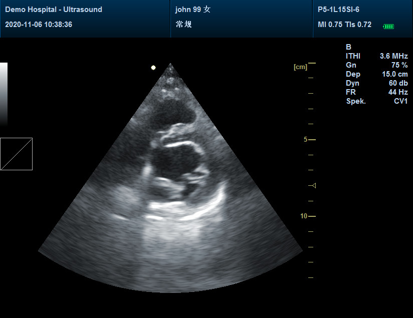 CMS1700A-VET Color Doppler 15″ Portable Laptop Convex Probe Animal Ultrasound