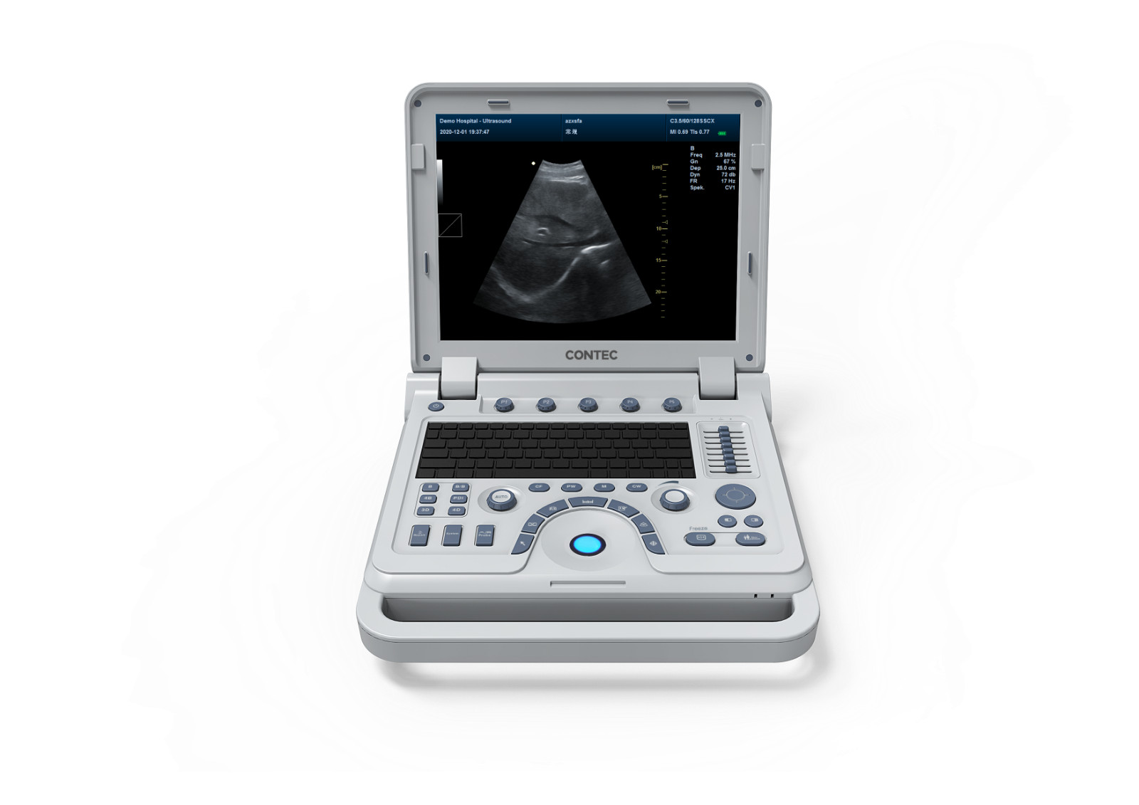 CMS1700A-VET Color Doppler 15″ Portable Laptop Convex Probe Animal Ultrasound