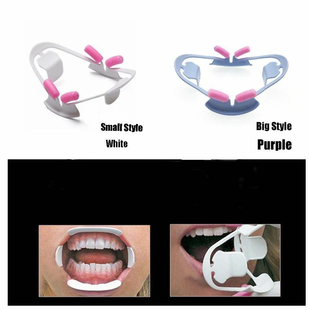 3D Dental Orthodontic Oral Mouth Opener Adult Intraoral Cheek Lip Retractor L/S