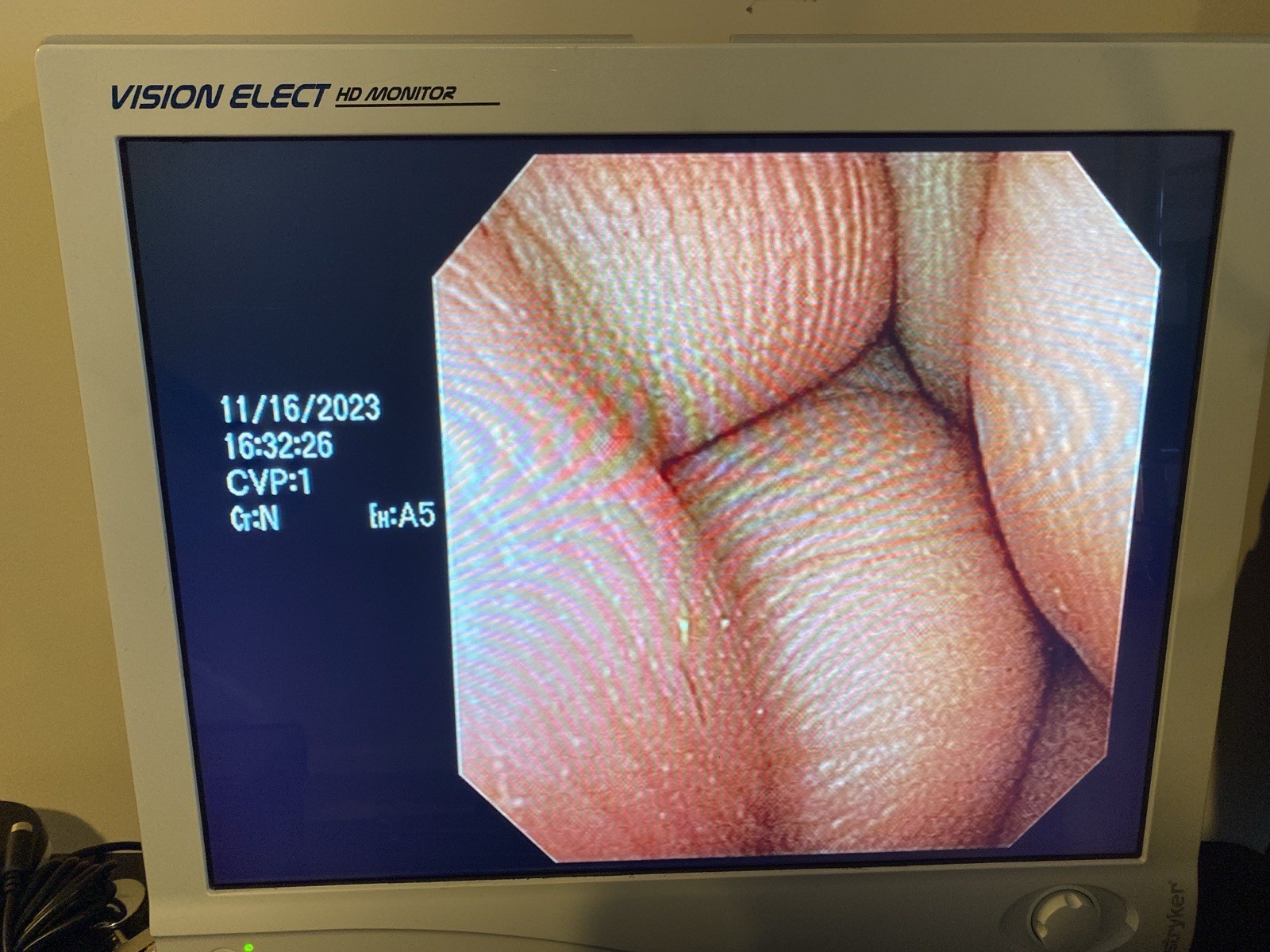 Olympus CYF-V2 Cysto-Nephro Videoscope Endoscope