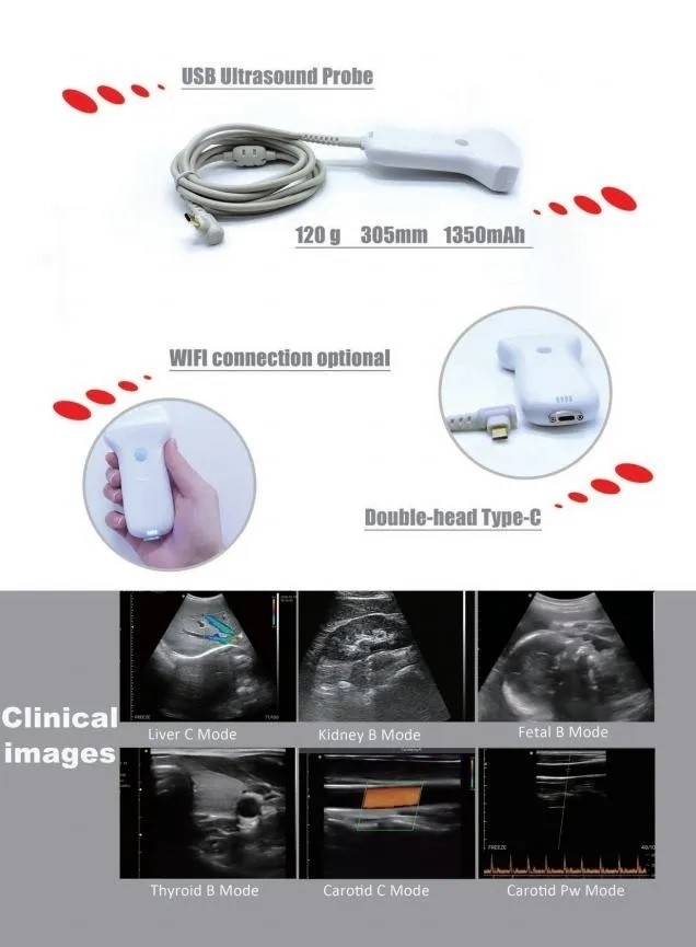color doppler linear/convex 128 Elements Wireless Ultrasound Probe