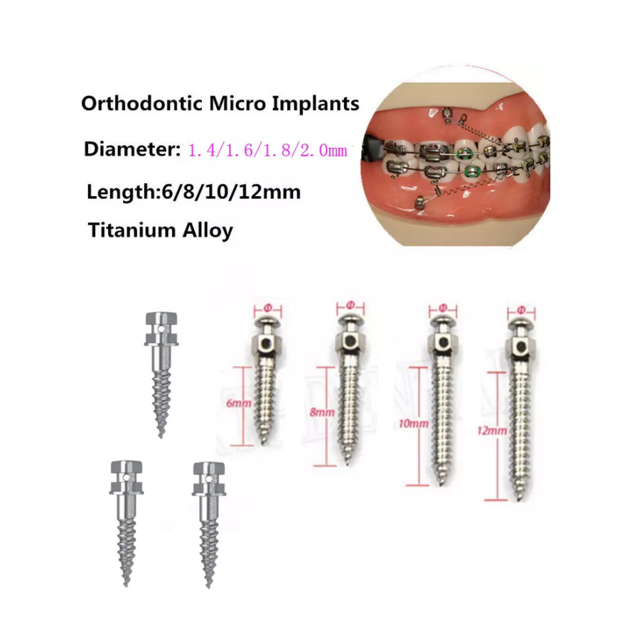 Dental Ortho Screw Micro Anchorage Mini Anchor Screws Titanium Temporary Implant
