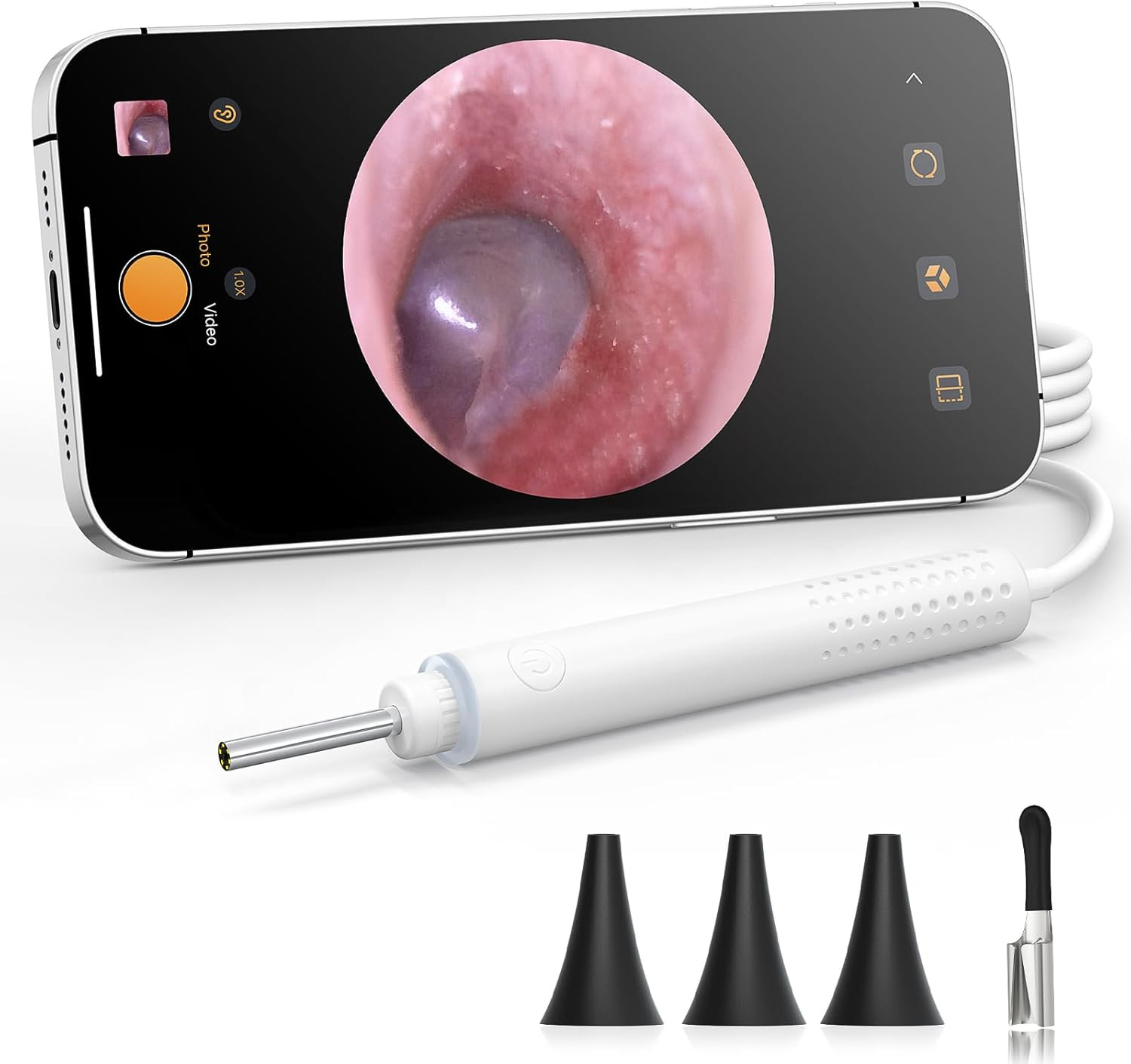 720P HD Ear Camera Otoscope with Light – Plug & Play, USB-C Port