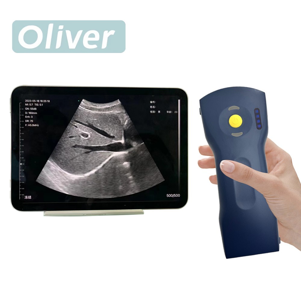 256E 3 in 1 Wifi Wireless Color Ultrasound Doppler Scanner