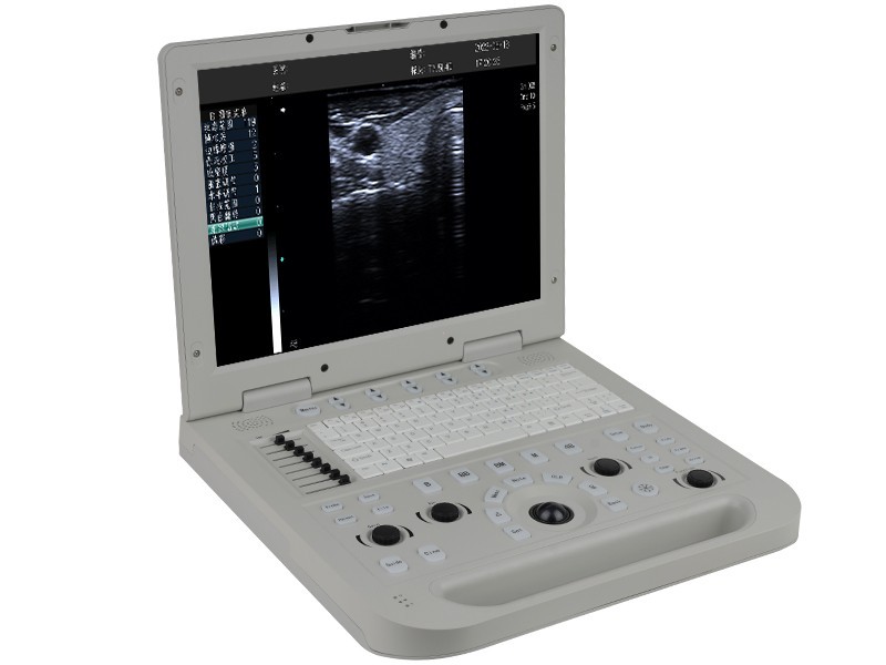 Full Digital Laptop Color Doppler Ultrasound Scanner for Doctor & Clinic
