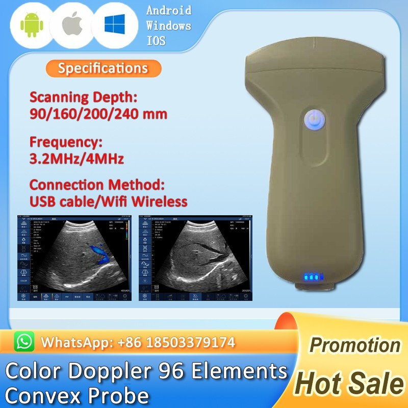 Portable Ultrasound Wifi Color Doppler 96-256 Elements Convex/Linear/Phased Aray