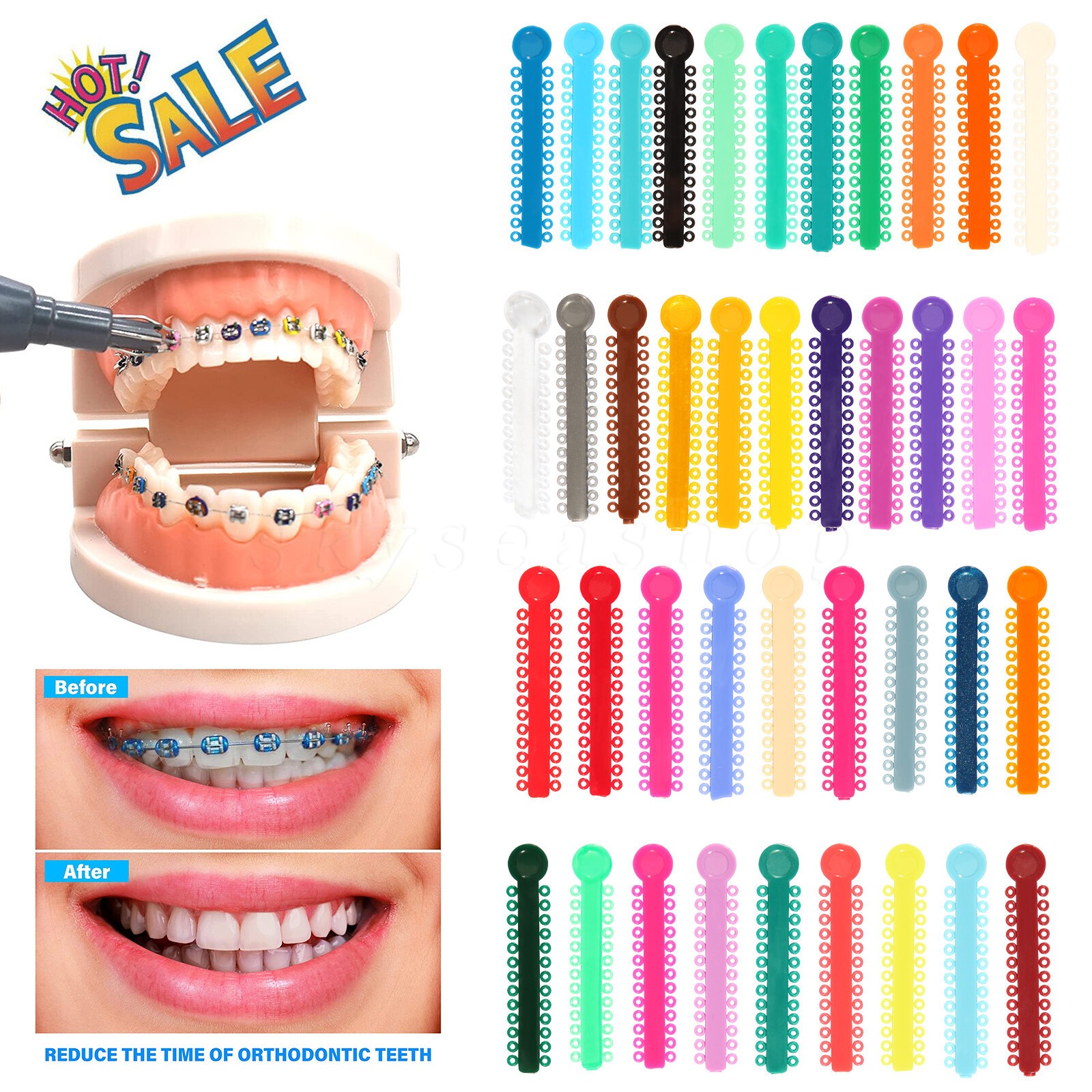 1040Pcs Orthodontic Bracket Elastic Ligature Ties Rubber Bands For Sale Braces