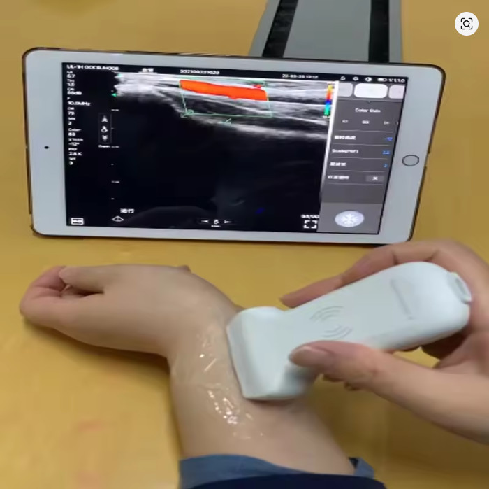 color doppler linear/convex 128 Elements Wireless Ultrasound Probe