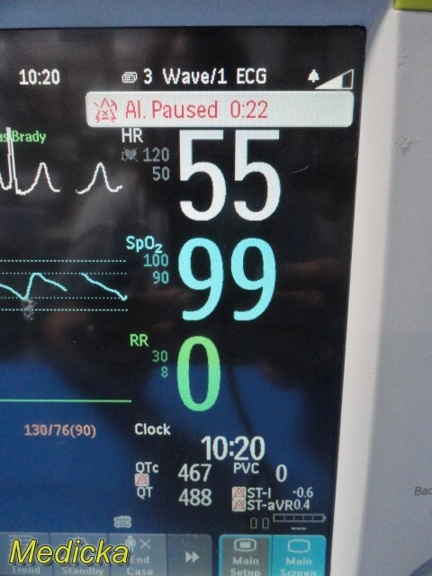 2010 Philips Intellivue MP30 Patient Monitor W/ MMS Module & NEW Leads ~ 35383