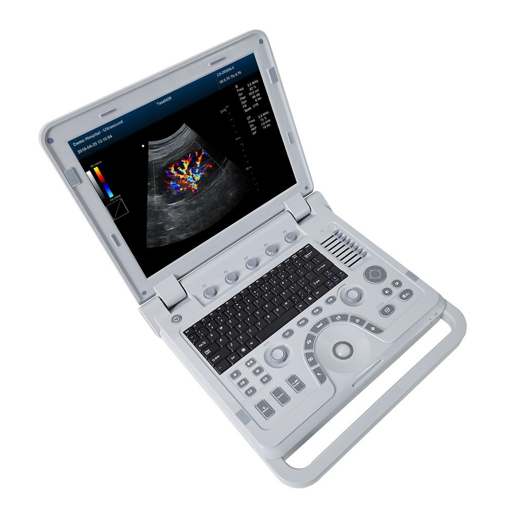 Portable Ultrasound Scanner Color Doppler Laptop Machine Convex TransVaginal CF