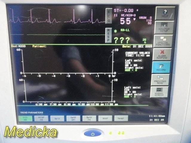 Spacelabs 91370 Ultraview SL Monitor- 91496 Module – ECG/SpO₂/NIBP/Temp ~ 38418