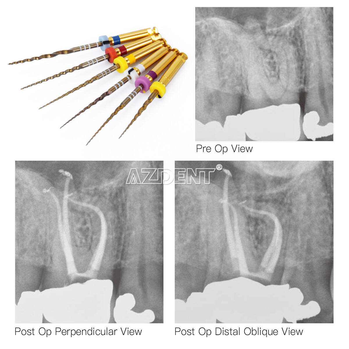 Diente Endodoncia Oro Taper NITI Archivos Rotativos Motor de Uso 25mm SX-F3