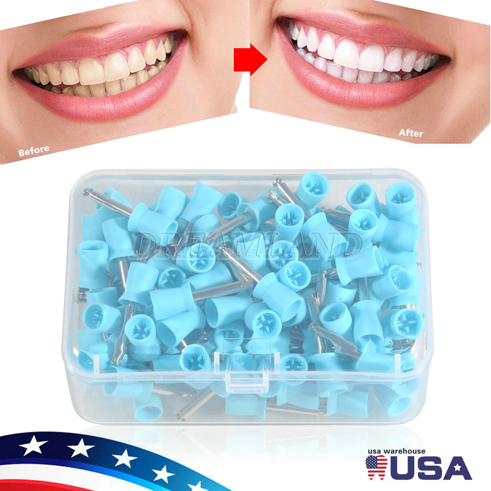 100x Dental Latch type Rubber Polishing Cups Brushes Tooth Prophy Polisher blue