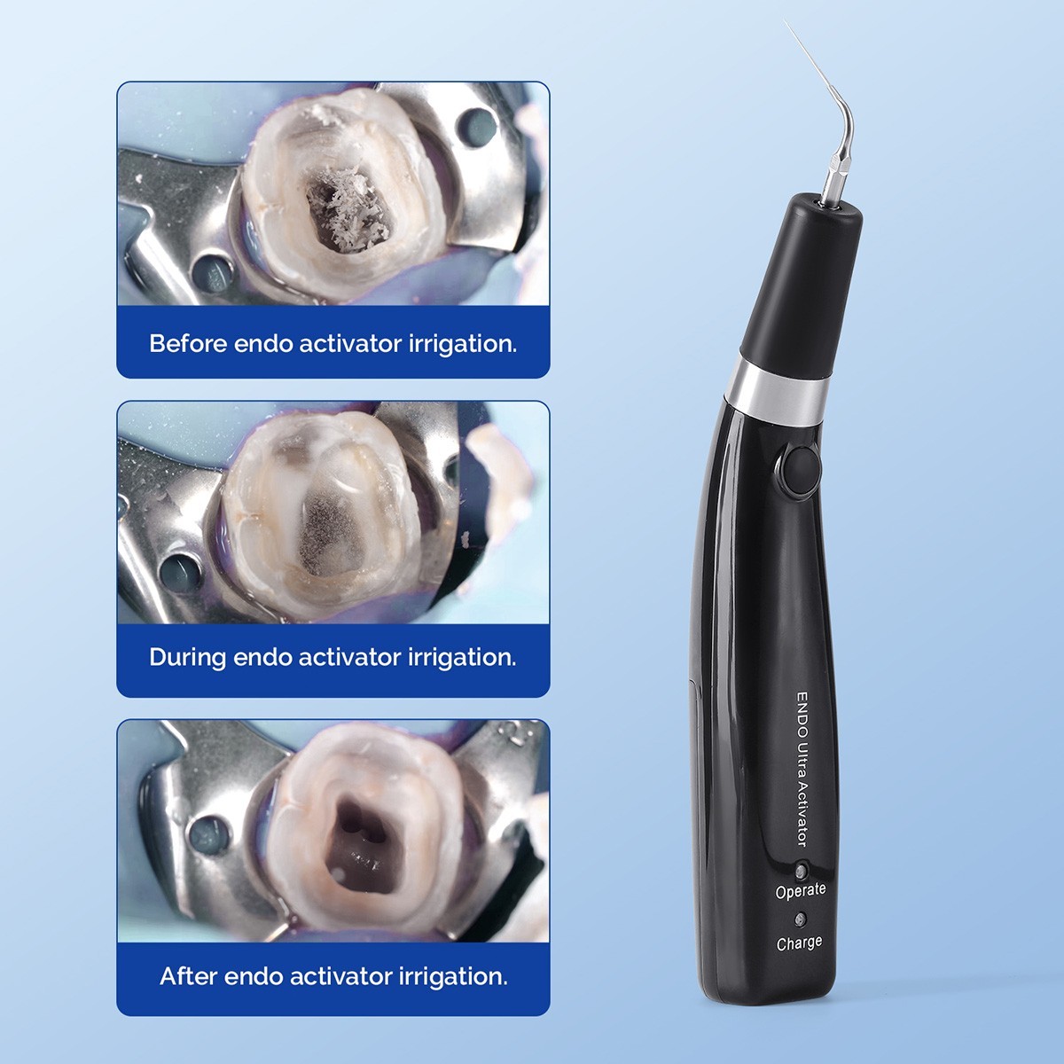 1X Dental Endo Ultra Activator Ultrasonic Irrigator Root Canal Scaling Handpiece
