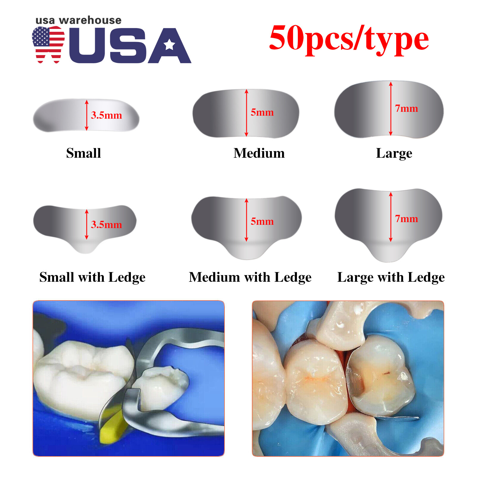 50Pcs/1box Dental Metal Matrices Matrix Band Sectional Contoured Refill SML 35μm