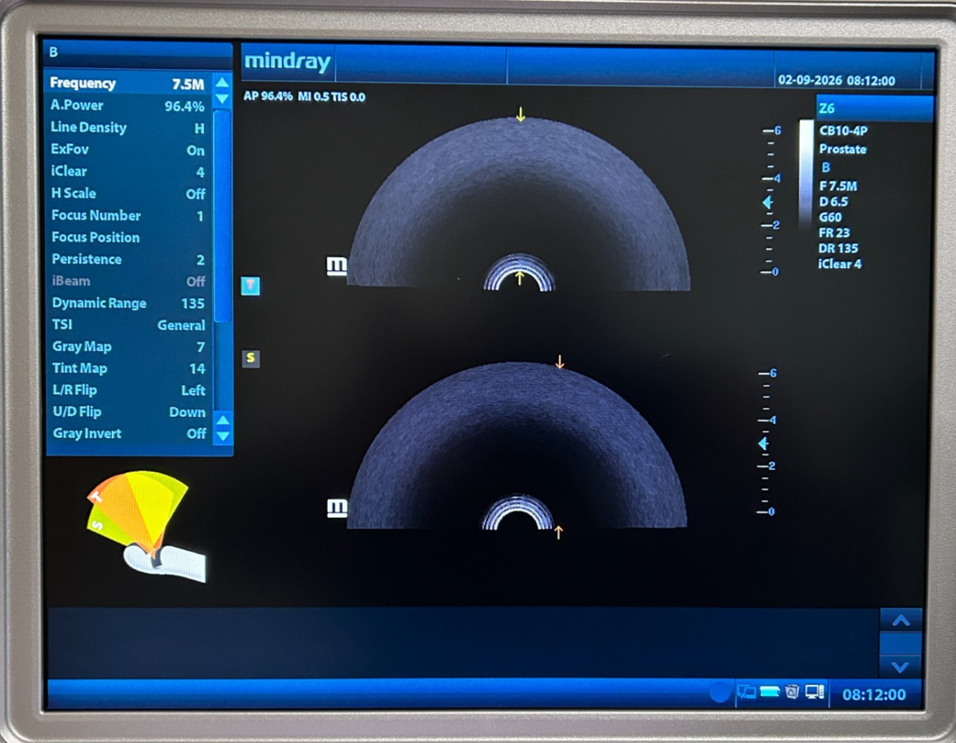 Mindray CB10-4P Biplane Intracavity Convex/Convex Probe, Tested and Warranty