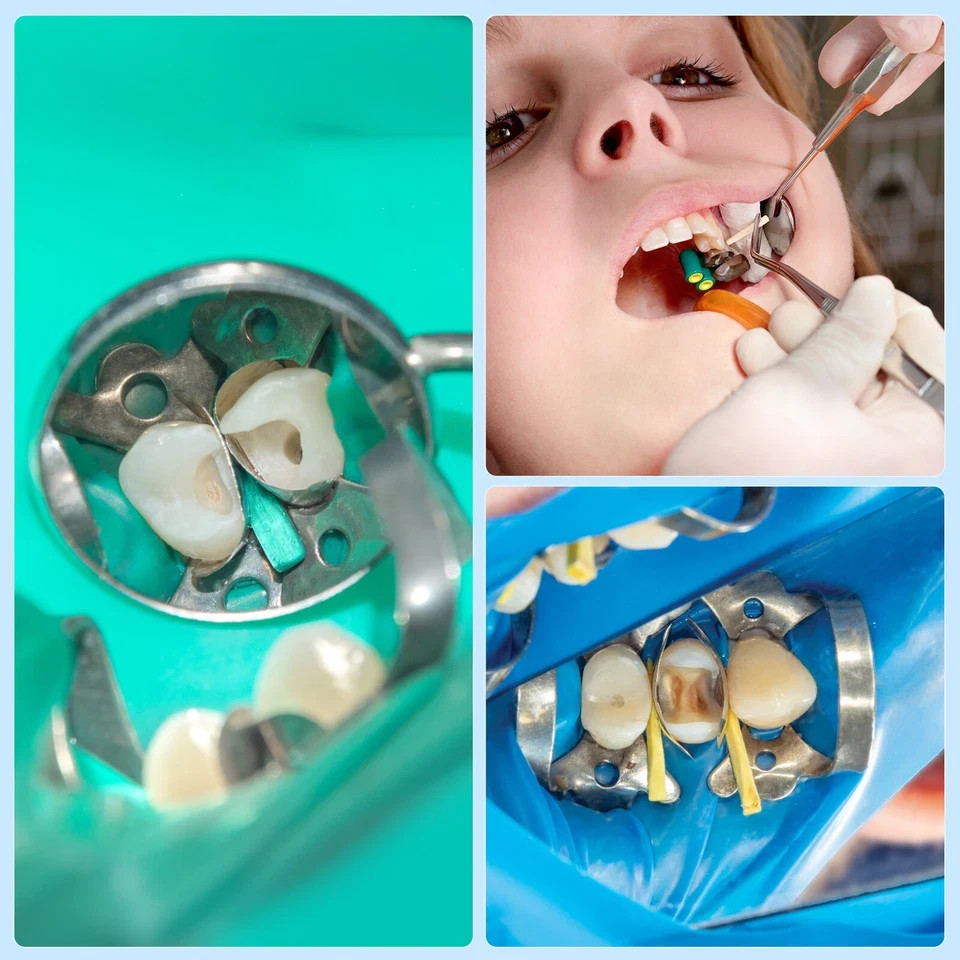 Dental Disposable Plastic/Wooden/w Hole Interdental Composite Diastema Wedges