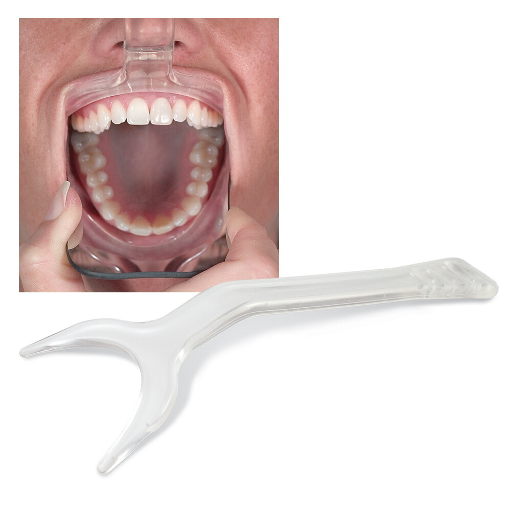 Easyinsmile Photography Cheek Lip Retractor Autoclavable Dental Mouth Opener 2pc