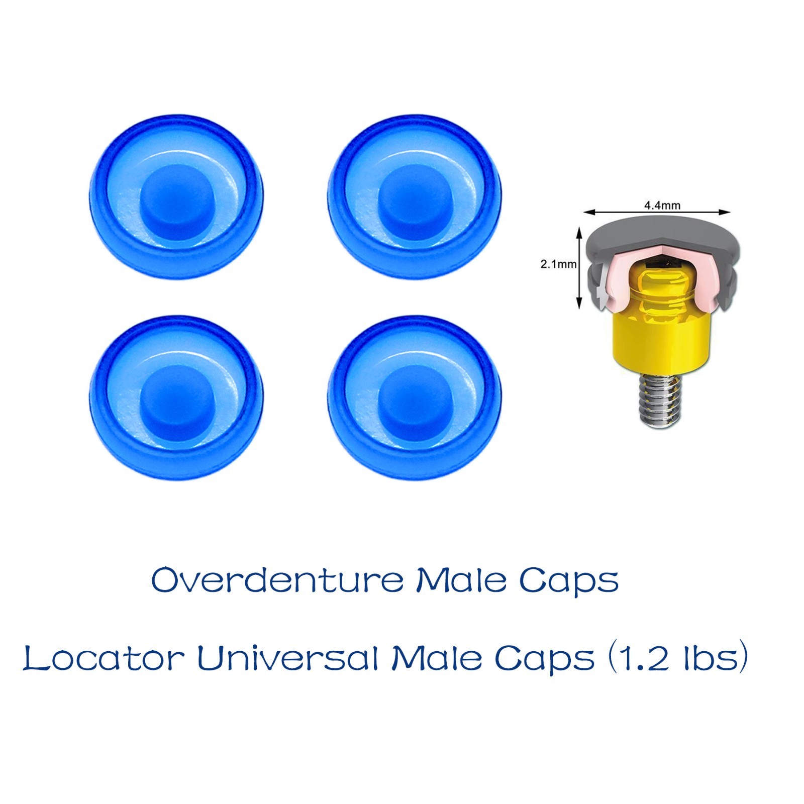 US Overdenture implant retention Male Cap Standard Blue 1.2lbs 4pcs Zest Locator