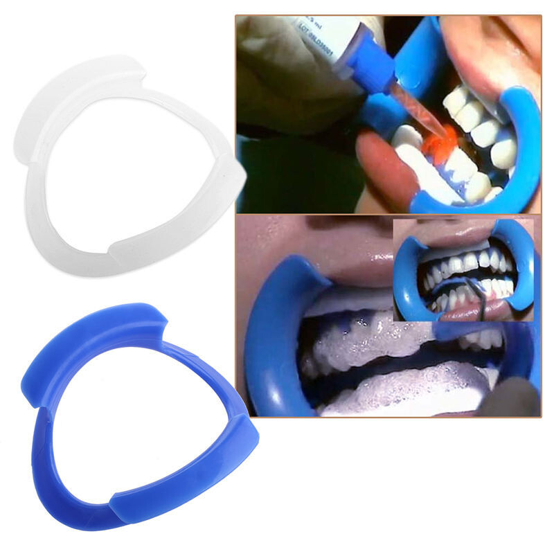 Dental Intraoral Retractor O-Shape Mouth Opener Plastic Blue/White Lips Holder