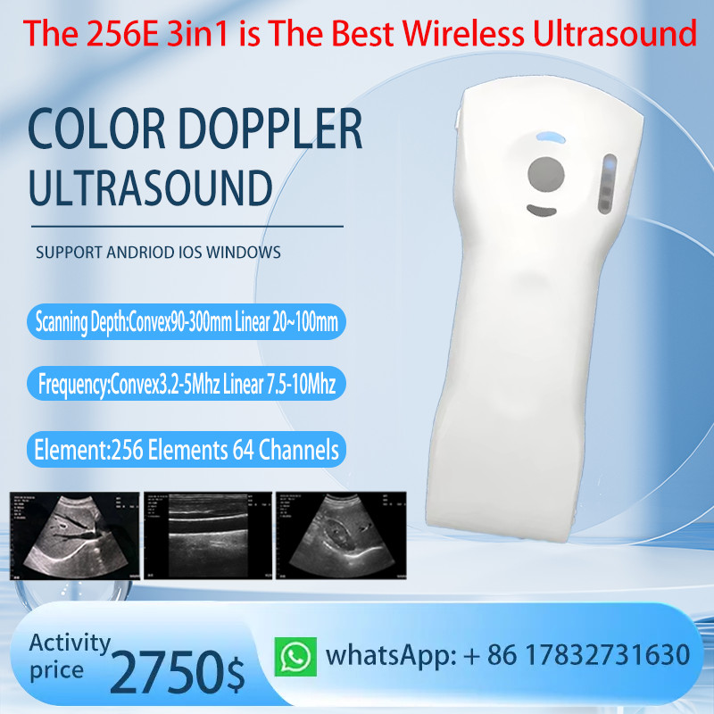 Wifi Wireless Color Ultrasound Doppler Scanner 256E 3 in 1 (64 Channels)