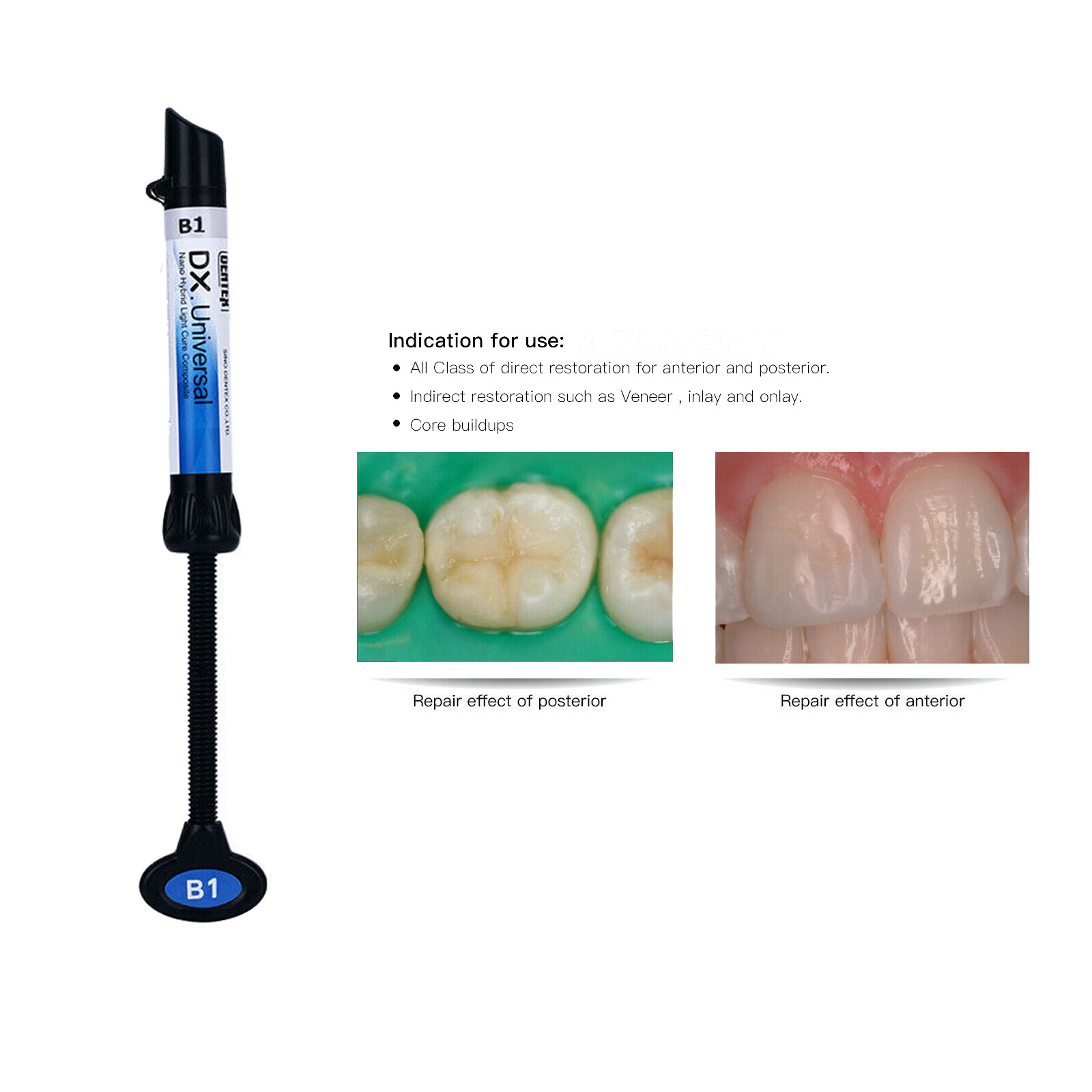 Dentex Dental DX Universal Light Cure Composite Resin Teeth Filling Material