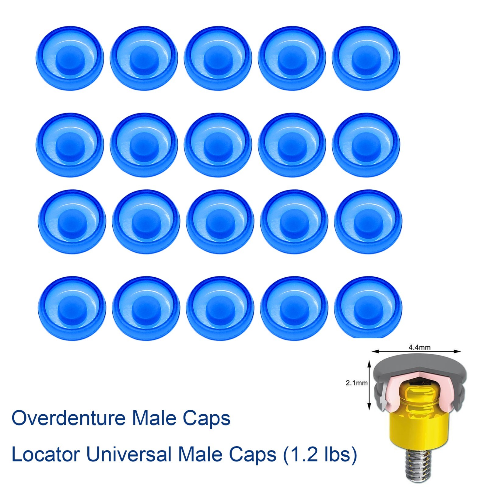 US Zest Locator system Male Cap Inserts 20Pcs Standard Replacement Compatible