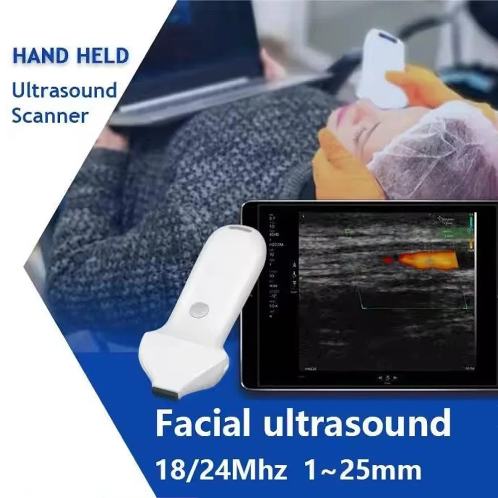 192E Wireless Color Doppler Ultrasound Probe Facial High Frequency Linear Probe