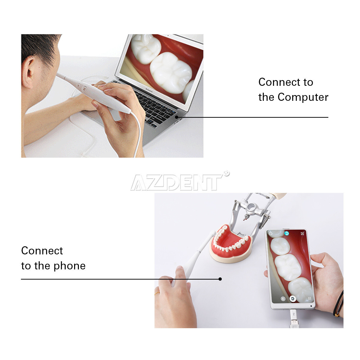 Dental Intraoral Camera USB Digital Imaging Intra Oral HD Camera 8 LED light