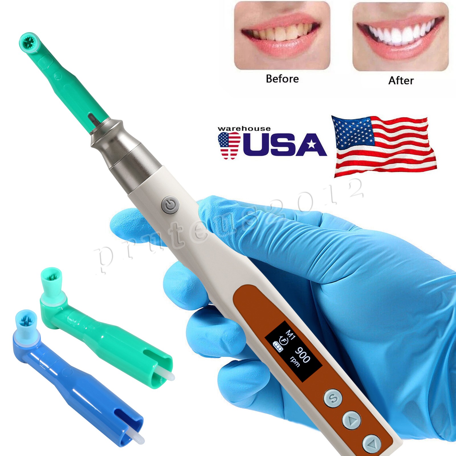 Woodpecker Style Dental Cordless Hygiene Prophy Polishing Handpiece 360° Sw