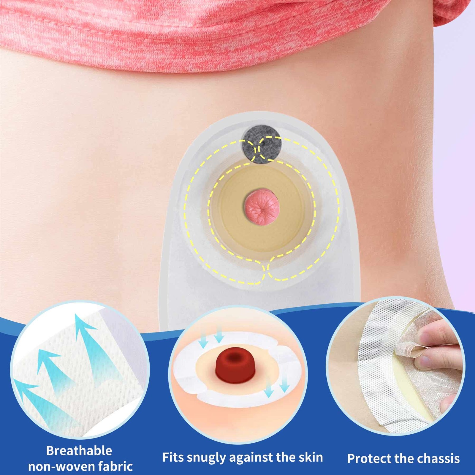Ostomy Barrier Strips,Ostomy Supplies,Elastic Skin Strip, 20pcs