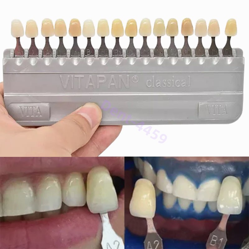VITA Classical Dental Shade Guide A1-D4 Teeth Whitening Classical 16 Colors