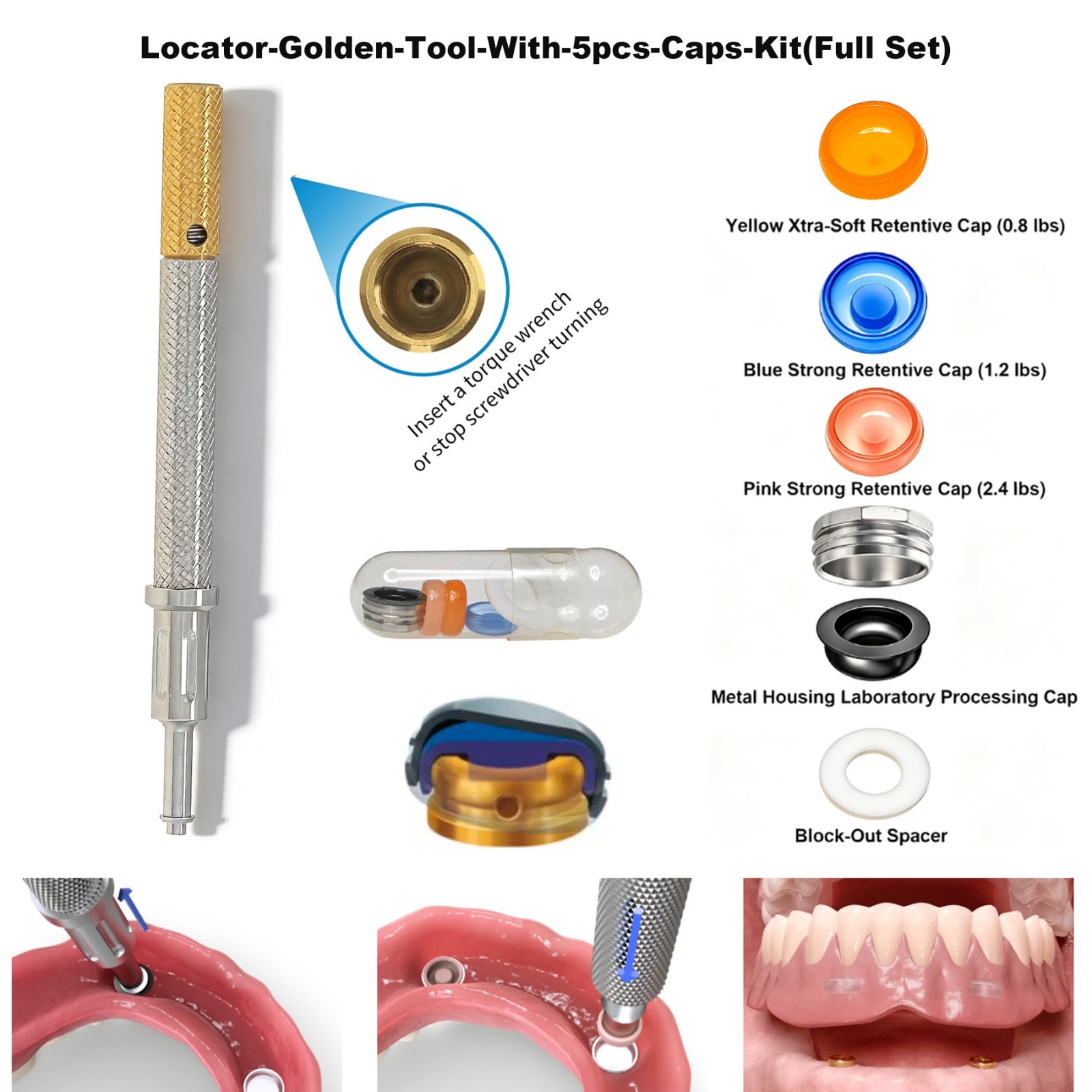 US Dental ZEST Locator Male Caps Kit Overdenture Replacement Inserts Core Tool