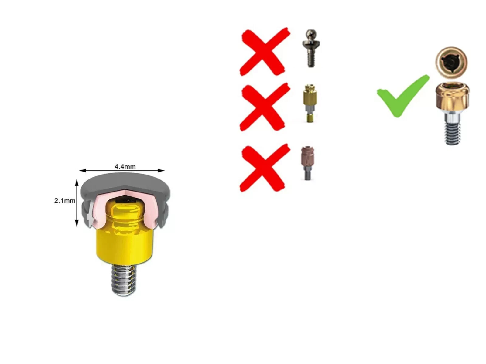 Locator Caps w/ PEEK Inserts 0.8-2.4lb Metal Housing & Spacers for Overdentures