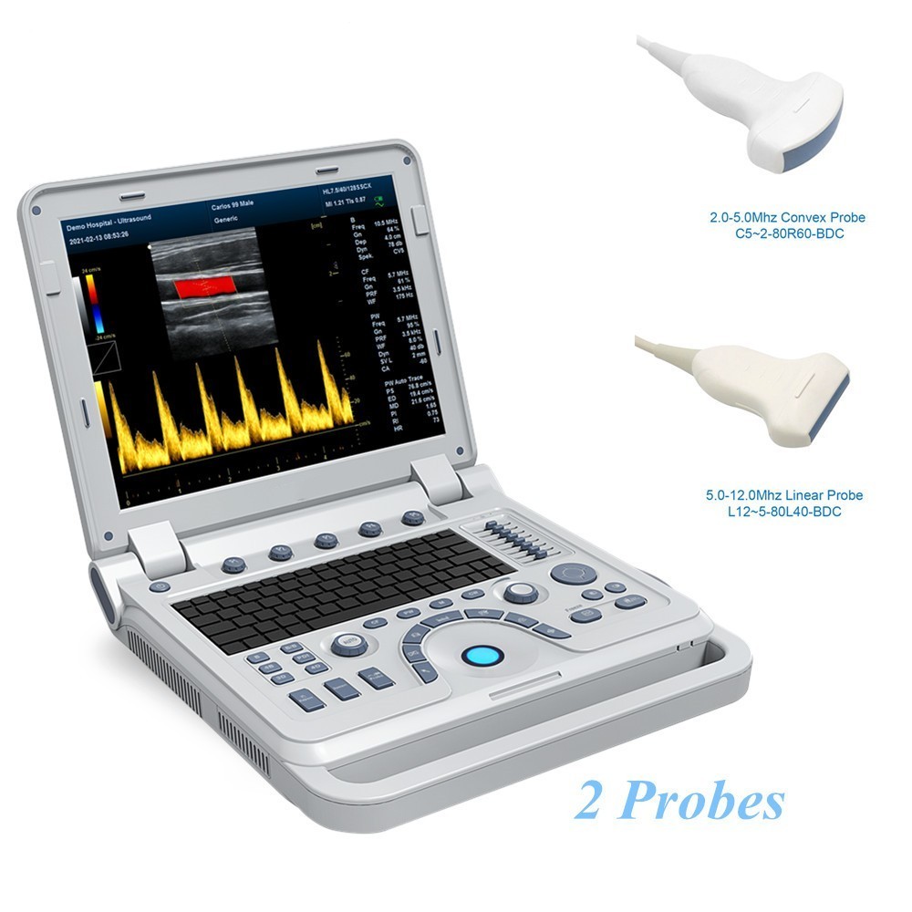 Portable Color Doppler Ultrasound Scanner Machine DiagnosticSystem Convex Linear