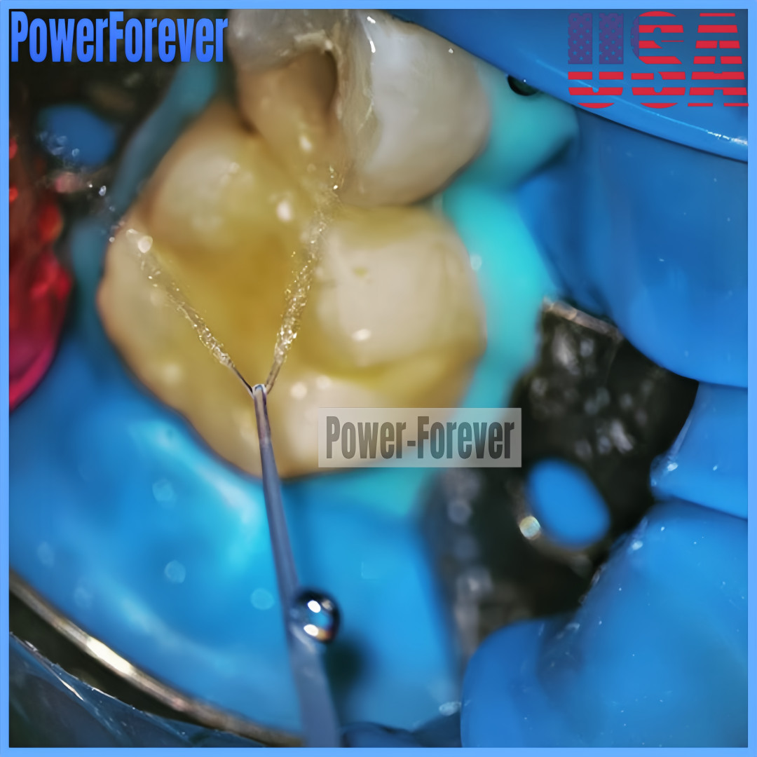 USA Dental PD Irrigator Tips Endo Root Canal Irrigation IrriFlex Style Flexible