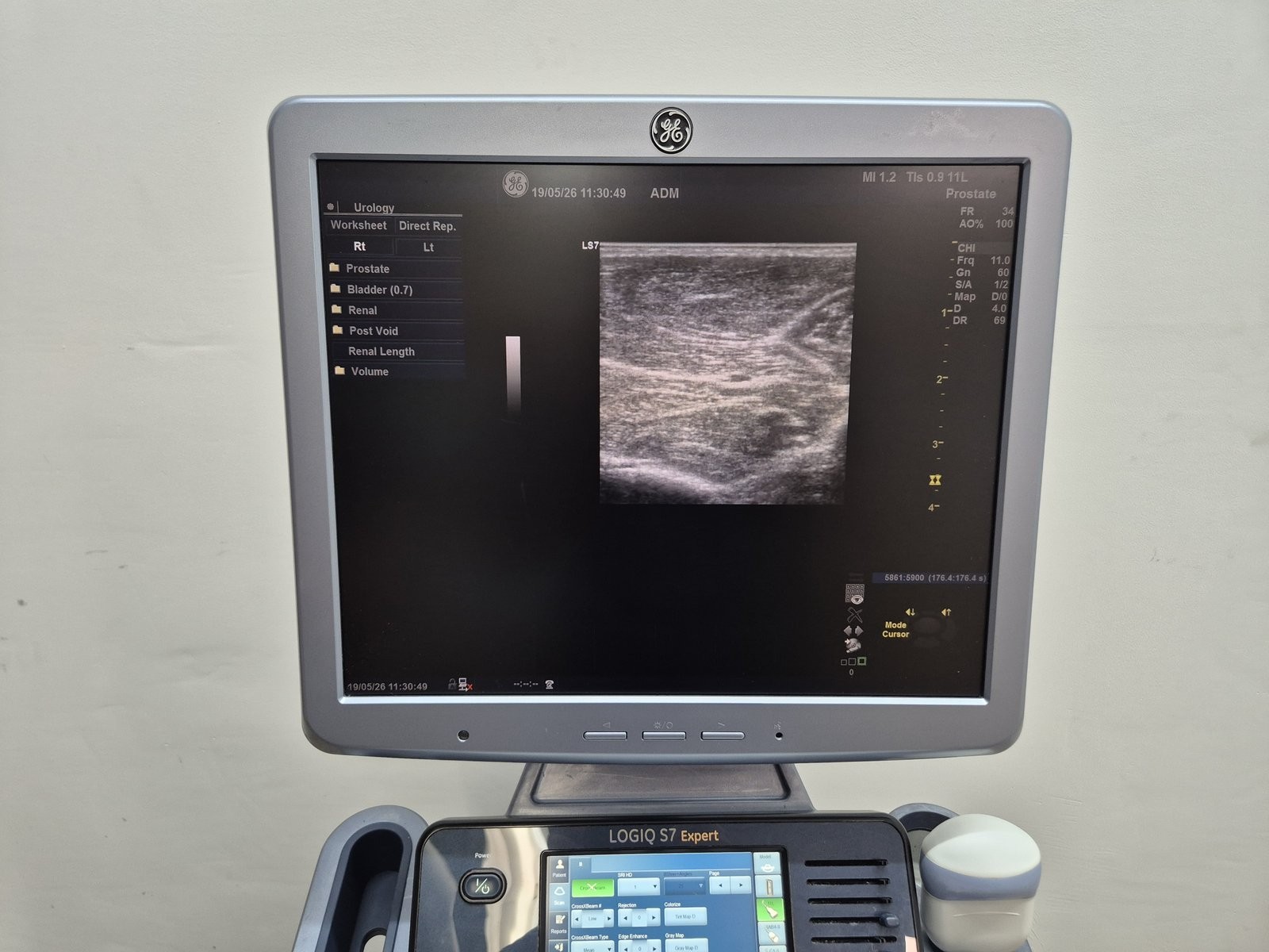 2022 GE 11L-D LINEAR ARRAY ULTRASOUND TRANSDUCER PROBE REF: 5176269 TESTED **