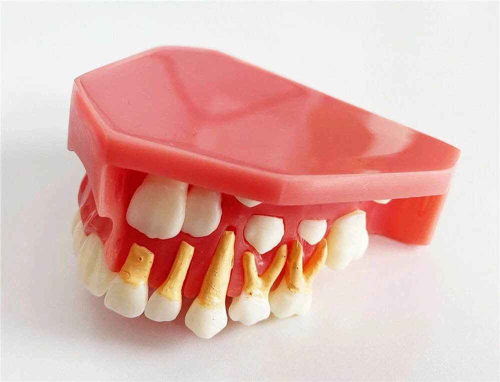 Dental Teaching Pediatrics TeethChildren 5-9Years Old Permanent Alternate Model-
