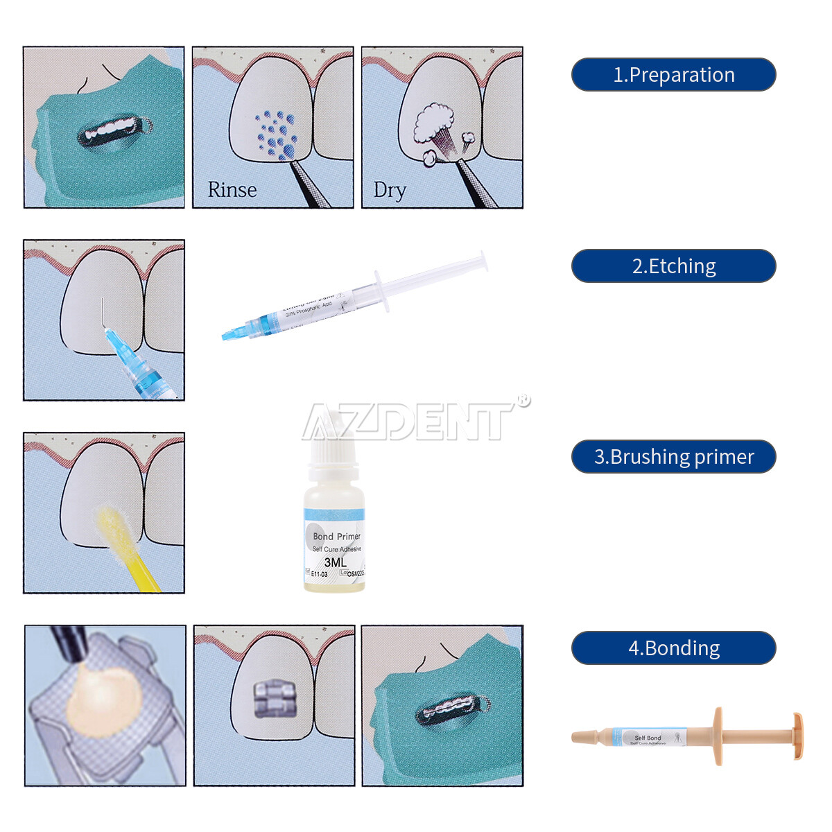 Dental Ortho Direct Bonding Mini/No-mix Resin /Light Cure Adhesive Bracket Kits