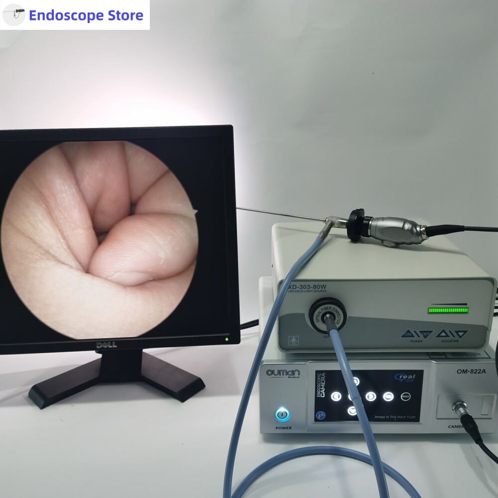 HD Rigid Endoscope Optics 0°/30°/45°/70° 2.7mm 4mm 175mm Sinuscope ENT Autoclave