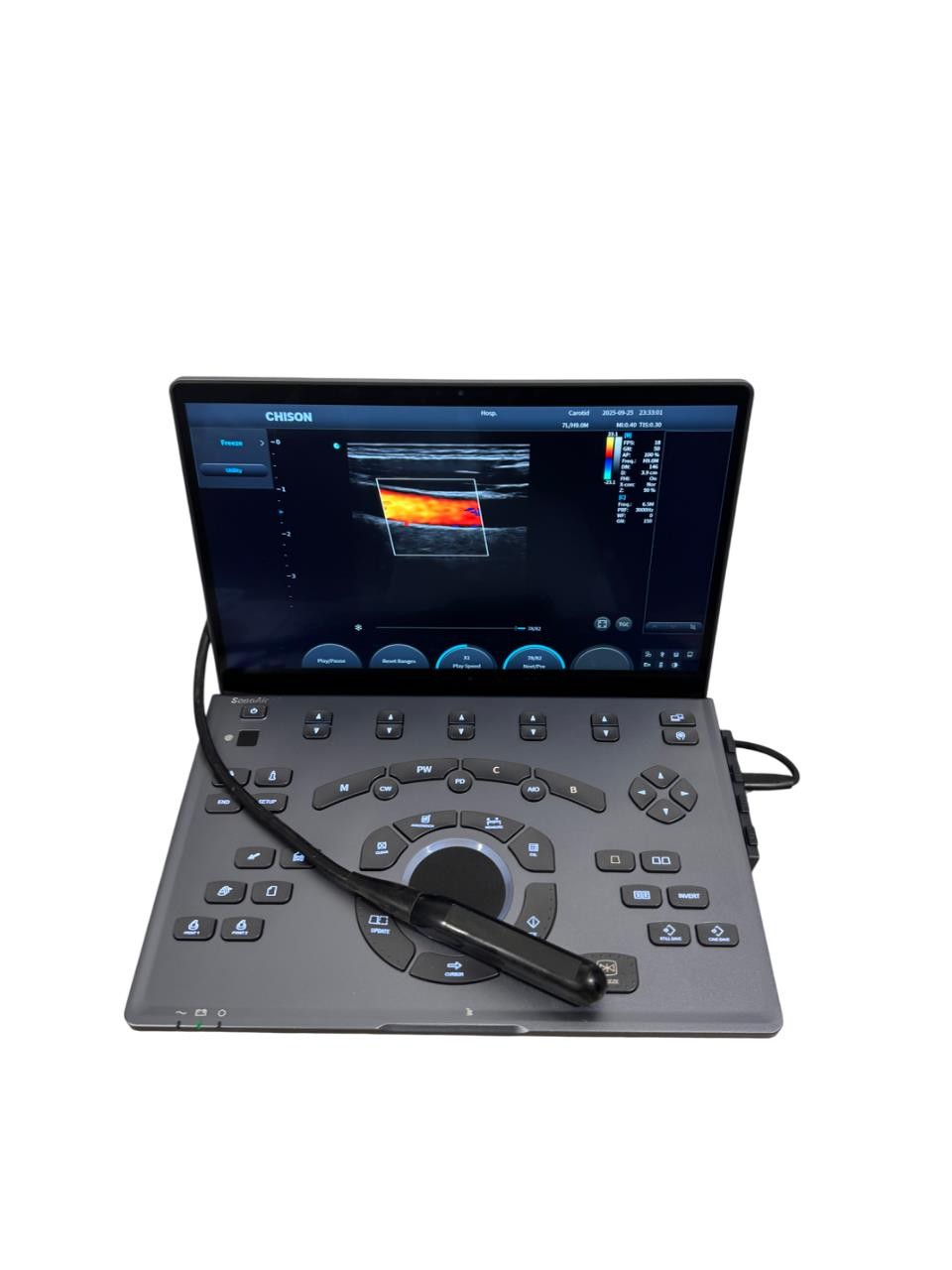 Color Doppler Portable Ultrasound SonoAir Vet with One Equone Rectal Probe-Used