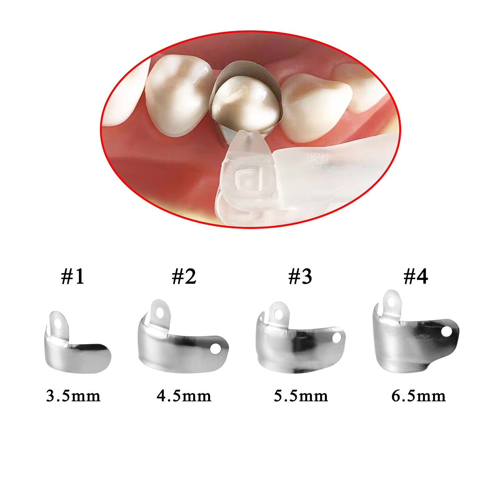 Dental Matrix Bands Ring Narrow Standard Ring Titanium Clamp Fit Garrison V3